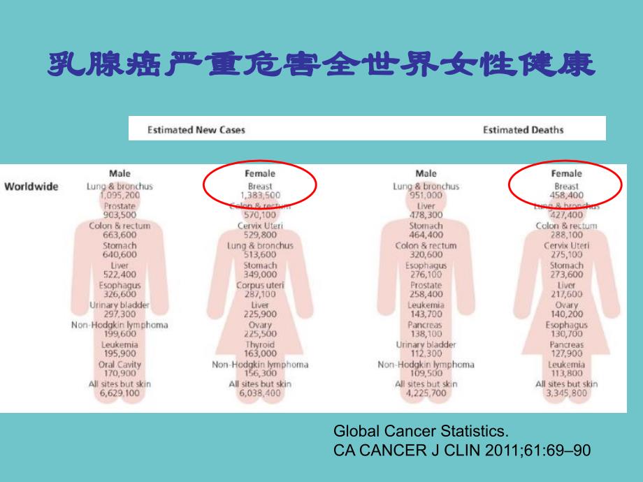 乳腺癌最新指南，理解、預防與應對乳腺癌的核心要點