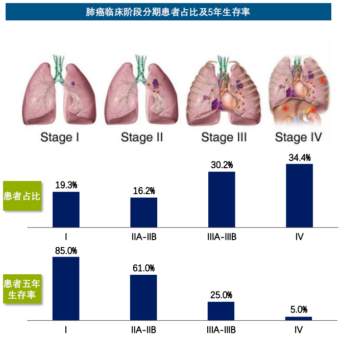 肺癌最新研究進展，突破瓶頸，迎來治療新希望