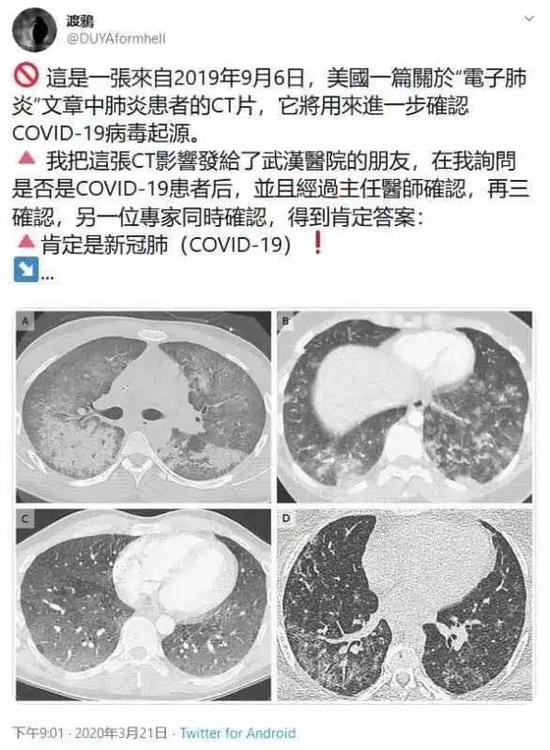 新冠肺炎起源的最新研究與探討